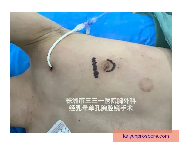 坎宁安气胸康复持续推进 活塞计划一周后复查评估